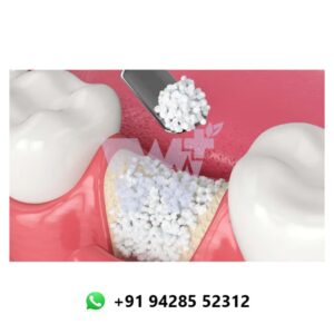Ammdent Osteoden Bone Graft