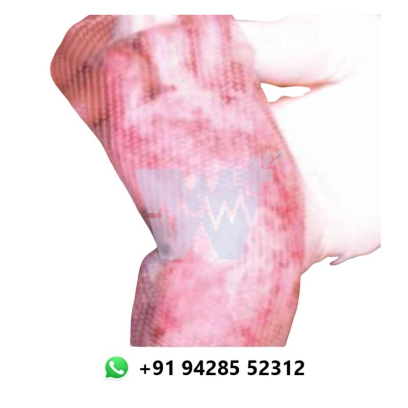 Surgiwear Non-Stick Mesh - Image 3