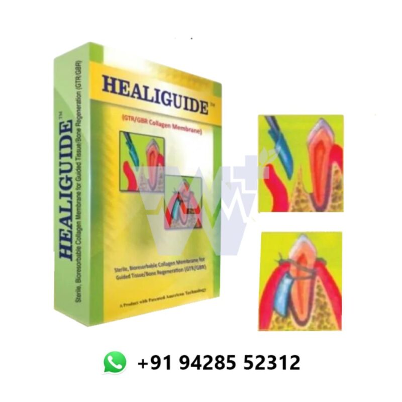 Advanced Biotech Healguide Bone Graft - Image 3
