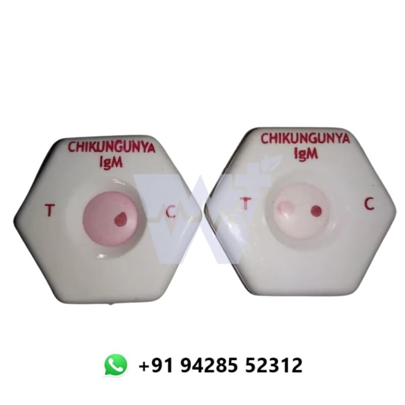 Bhat Bio-Scan Chikungunya IgM Spot Card
